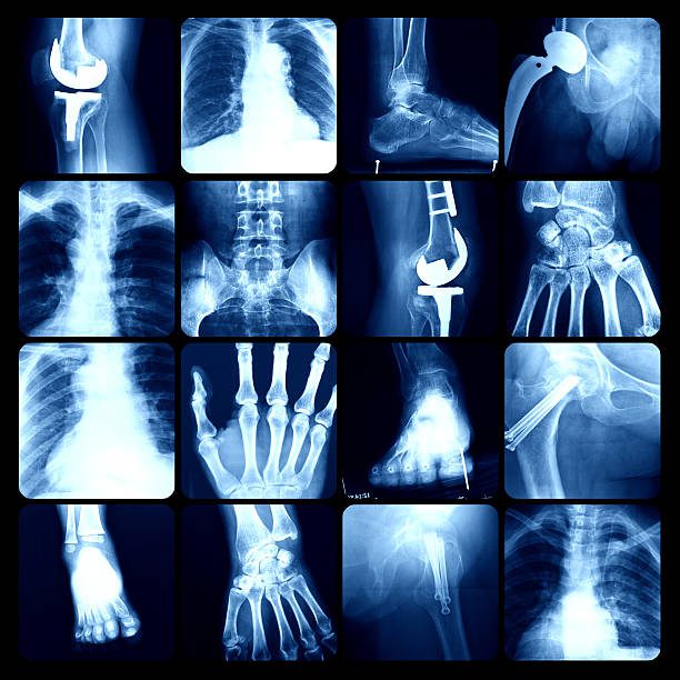 x-ray - huesos fotografías e imágenes de stock