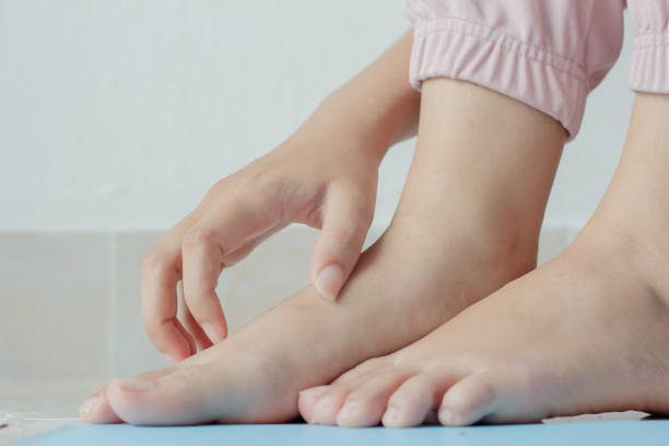 low section of child scratching foot on floor - infeccion de la piel fotografías e imágenes de stock